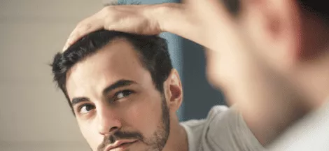 hair transplant