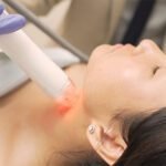 PRP Facial