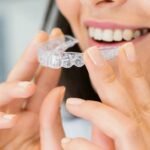 Invisalign Benefits and Cost Variations