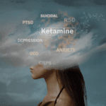 Ketamine Therapy Near Me
